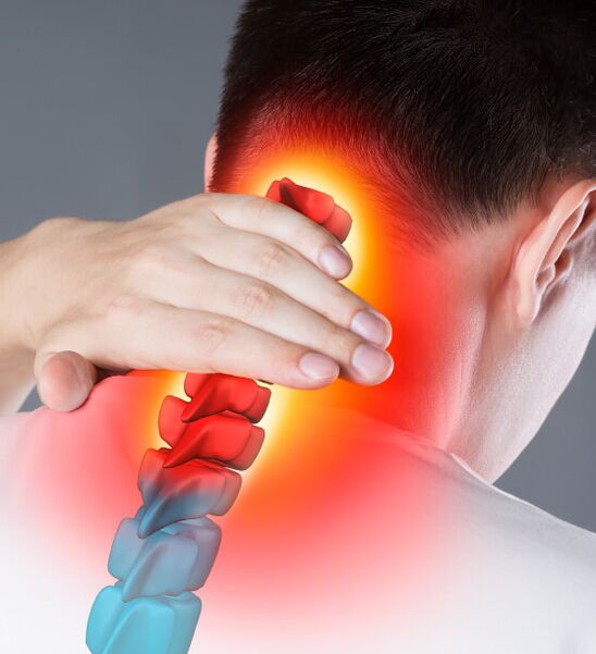 Servikal osteokondroz semptomları