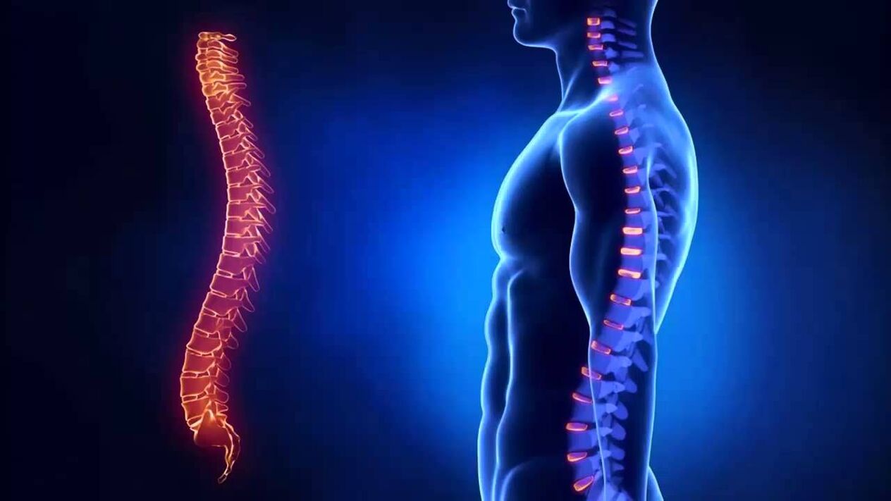 Osteokondroz, hastalığın geliştiği omurga bölümlerine göre sınıflandırılır.